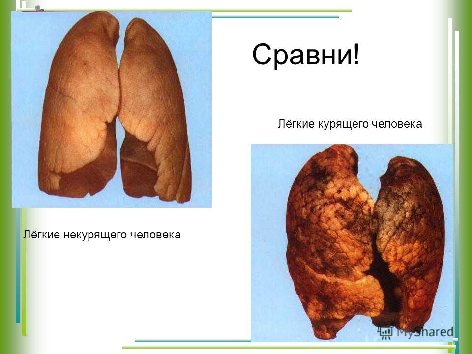 Чистка лица / Отзывы и цены Ультразвуковая чистка лица Детская поделка Торт