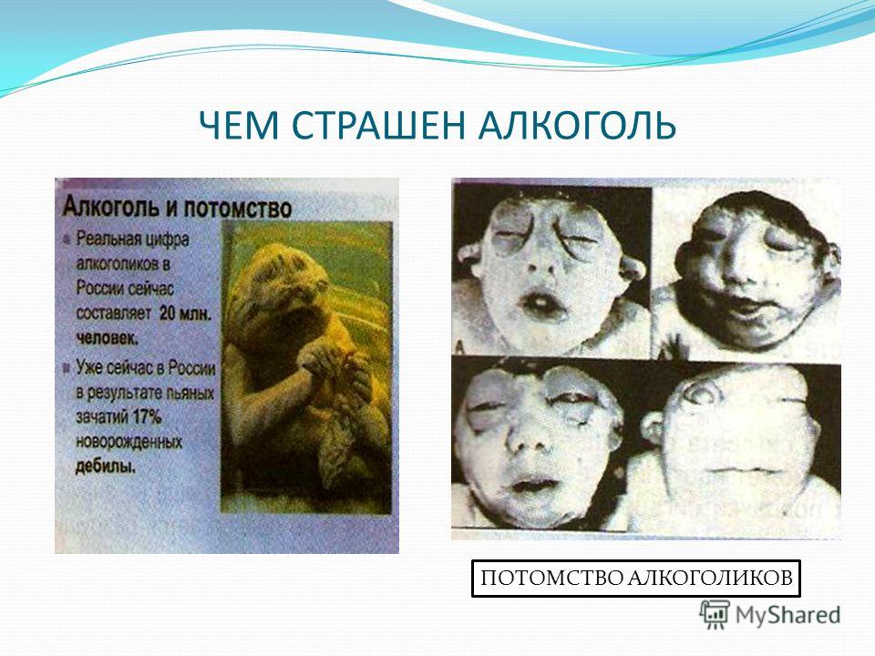 Таблетки от алкоголя колме цена