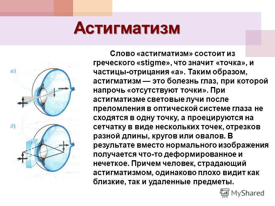 Глазные капли для улучшения зрения офтан катахром отзывы
