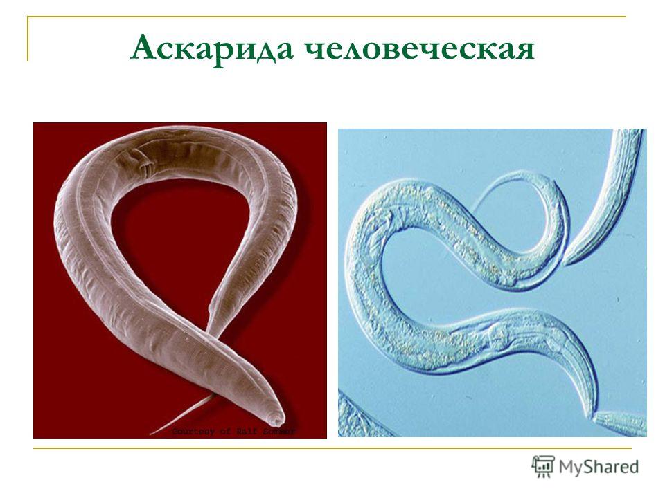 Реферат Про Паразитического Червя Аскарида Реферат Про Паразитического Червя Аскарида