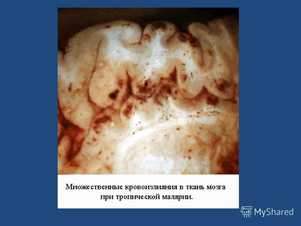 определение паразитов в организме определение паразитов в организме