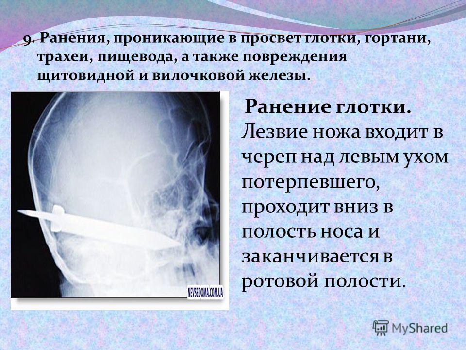 Отец Изначально Трахеи Порно Дочь Деревянко Русский