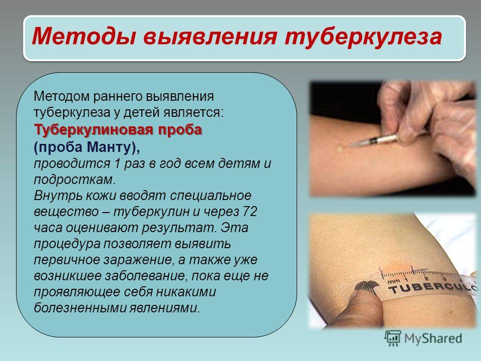 Как сделать манту ребенку 559