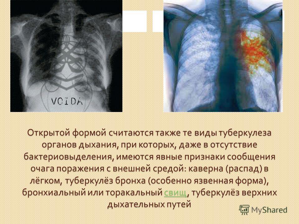 Признак того что форма открыта Признак того что форма открыта