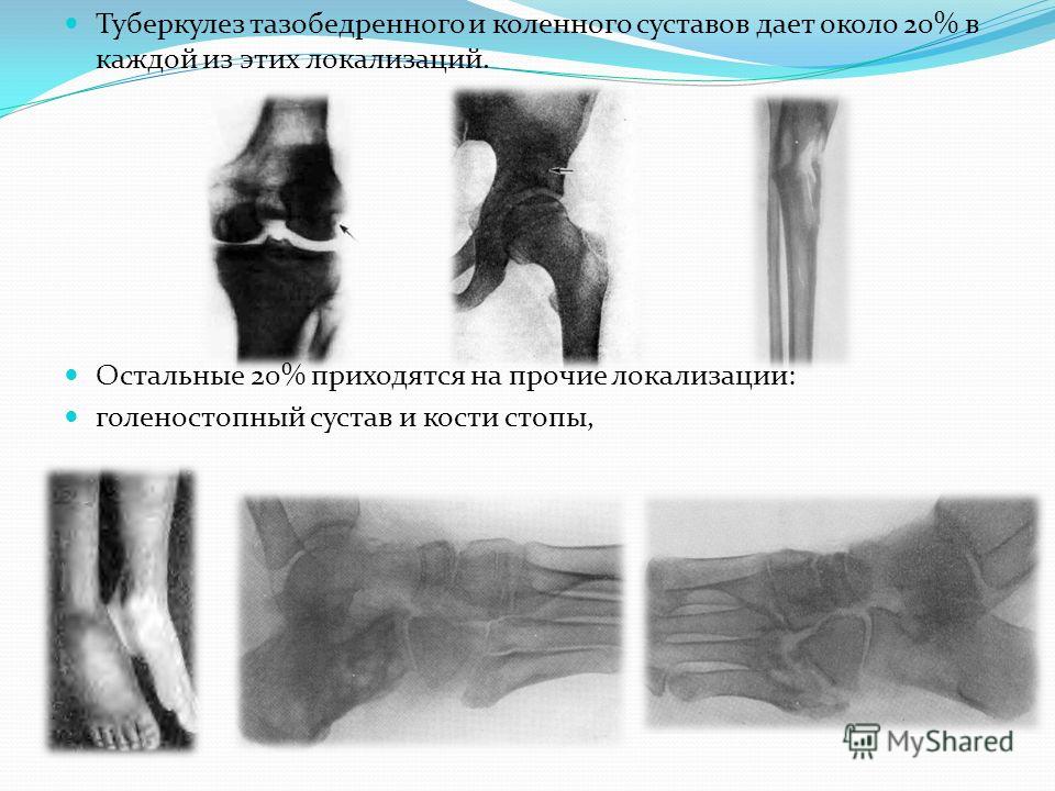 узи тазобедренных суставов у грудничков стоимость