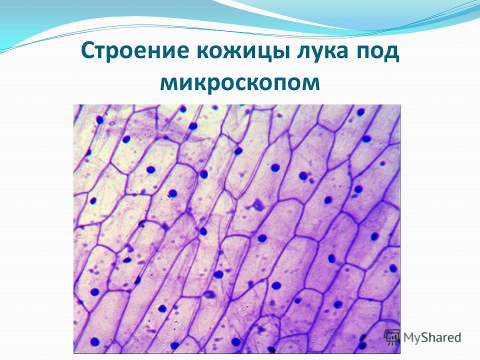 Фото Кожицы Лука Под Микроскопом Фото Кожицы Лука Под Микроскопом