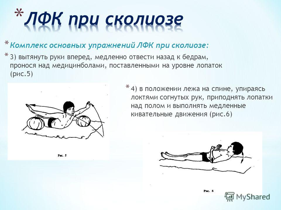 Массаж в домашних условиях от сколиоза 241