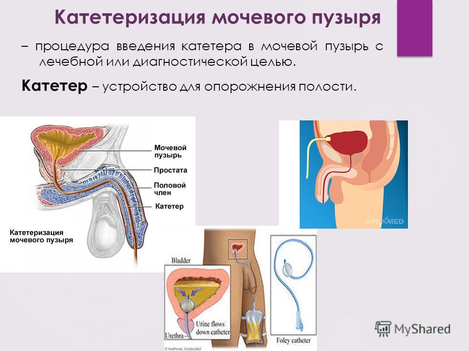 Плед своими руками для новорожденного спицами