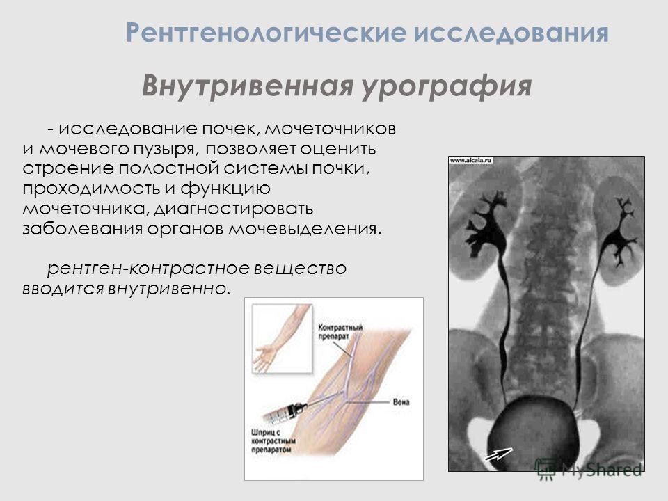 Как сделать урографию Как сделать урографию