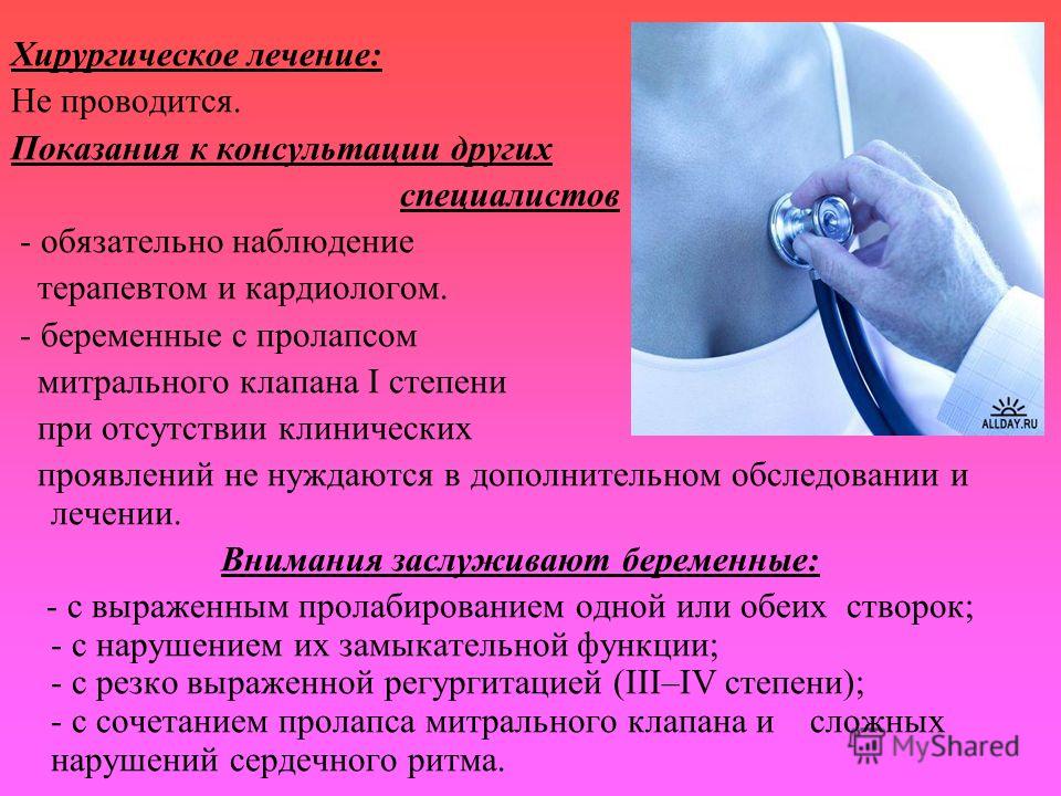 Пролапс митрального клапана у беременных 58