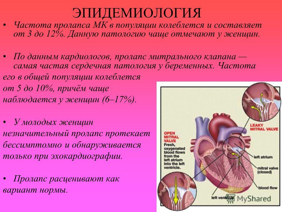 Диета При Пролапсе Митрального Клапана 3 Степени