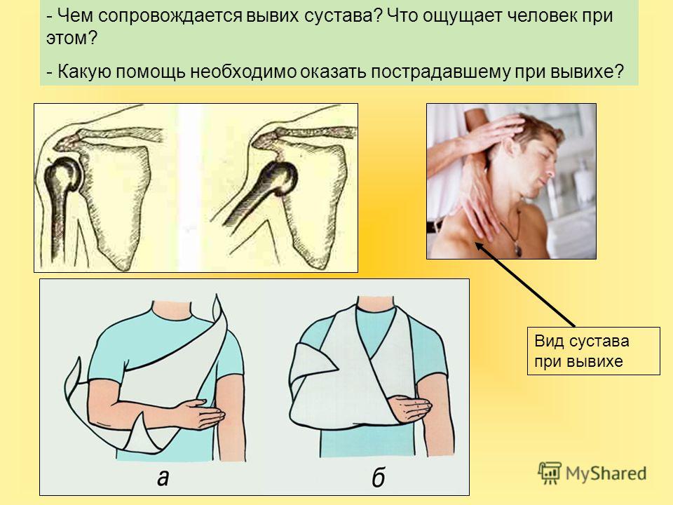Помощь вывихе сустава динамические упражнения в плечевом суставе