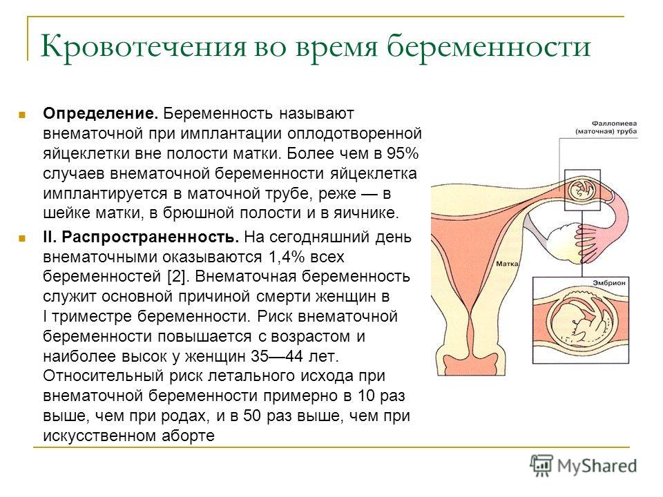 Имплантационное кровотечение при внематочной беременности 31