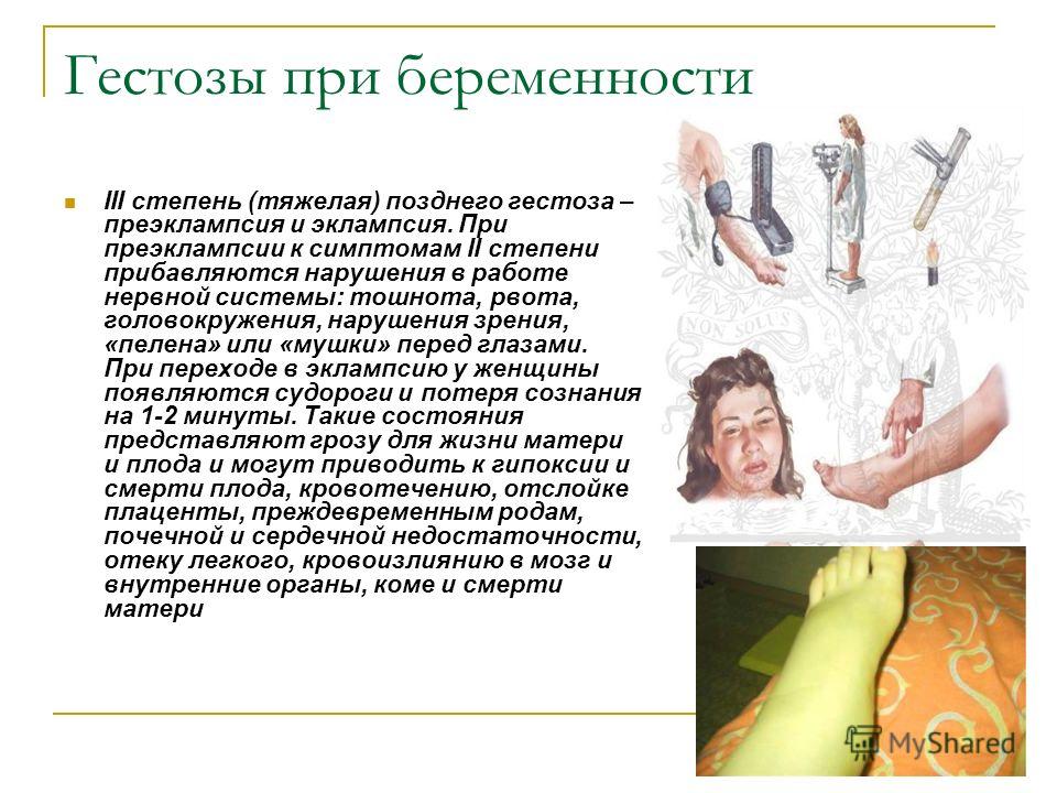 Эпителий у беременных норма в мазке у женщин 32