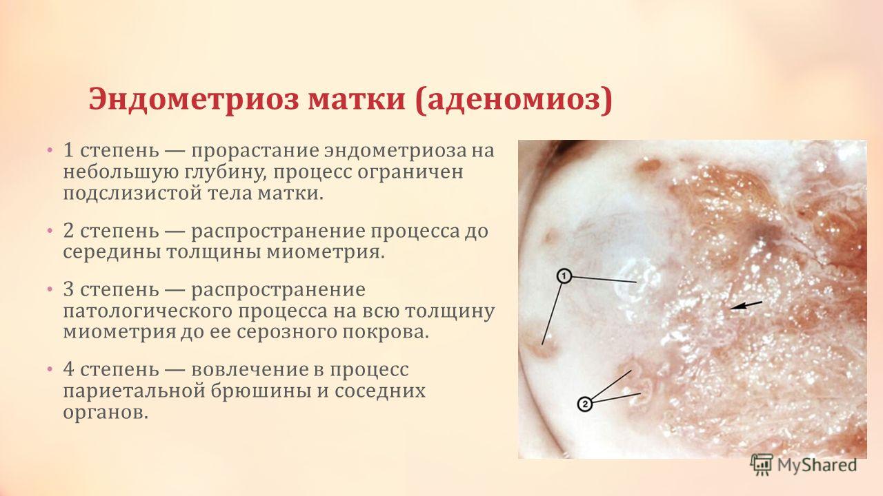 Новогоднее меню: 10 оригинальных блюд из курицы изображения Новогоднее меню: 10 оригинальных блюд из курицы изоражения
