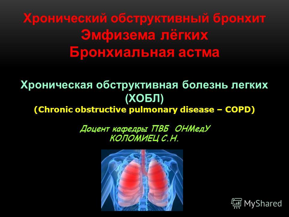 CV CV