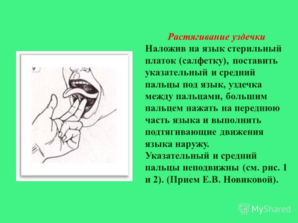Комплекс упражнений для растяжки уздечки языка Растяжение уздечек верхней губы и подъязычной Форум
