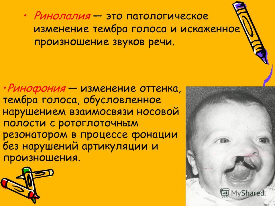 Нарушение голоса при ринолалии и ее коррекция Нарушение голоса при ринолалии и ее коррекция