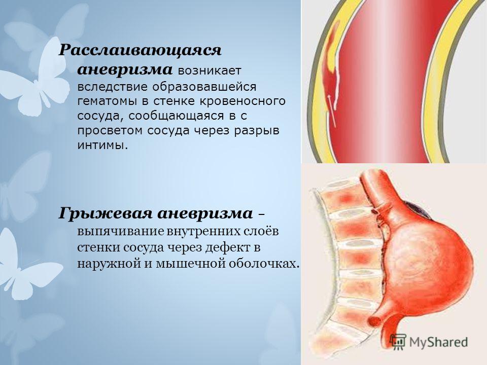 Периферический рисунок обеднен Комплексная лучевая диагностика рака легкого