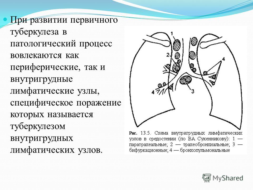 Как лечат туберкулез лимфатических узлов у детей Как лечат туберкулез лимфатических узлов у детей
