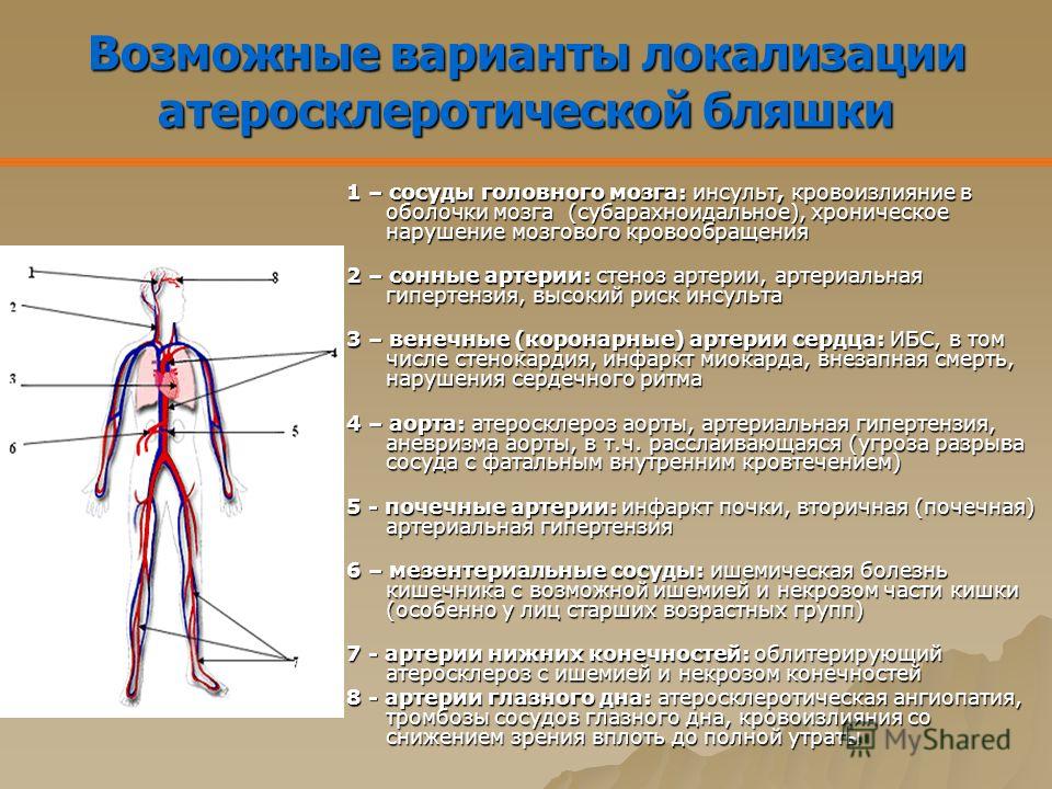 Атеросклероз сосудов факторы риска