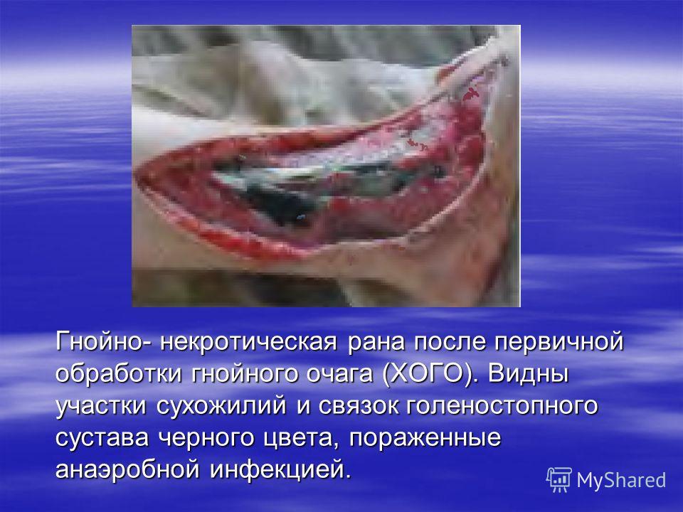 К чему снятся гнойные раны на теле К чему снятся гнойные раны на теле