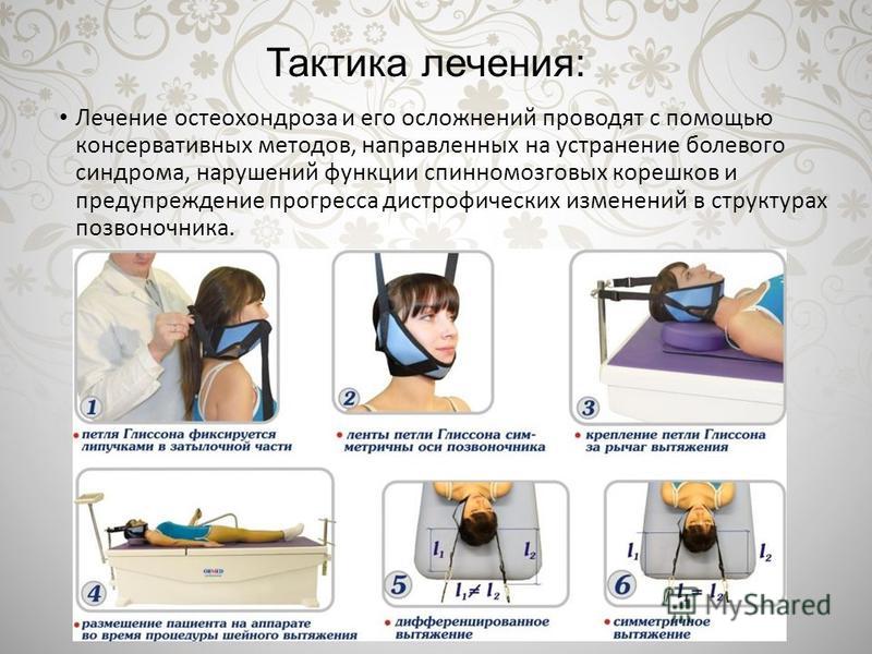 Схема лечения остеохондроза шейного отдела позвоночника медикаментами Схема лечения остеохондроза шейного отдела позвоночника медикаментами