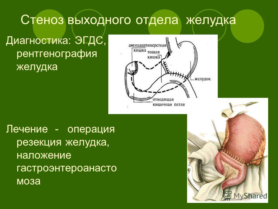 Хватит бухать и на выходных нюхать