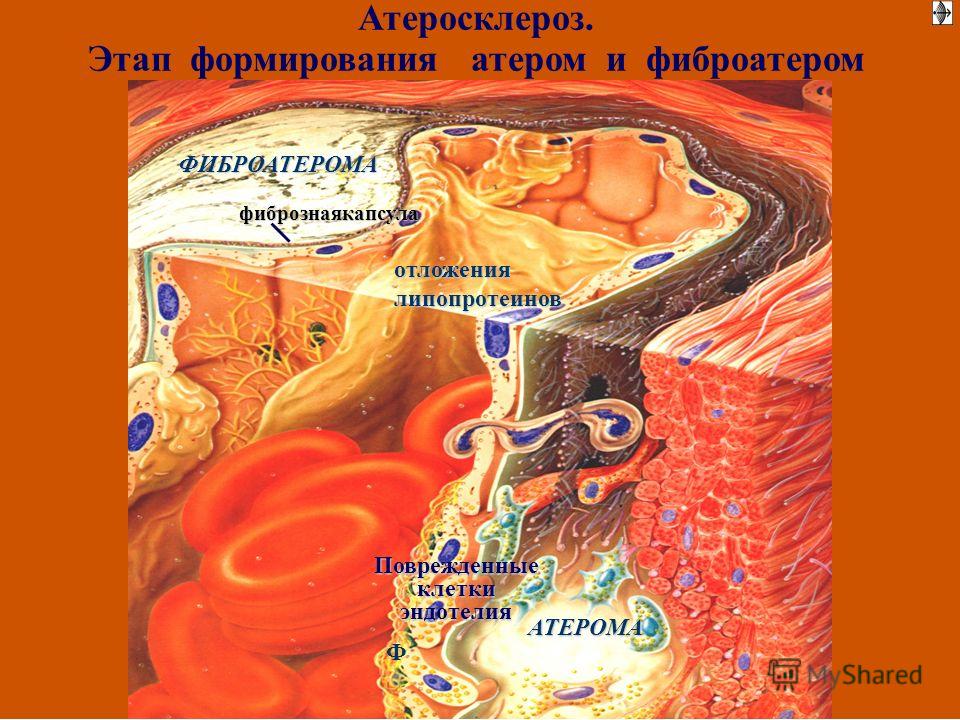 твердый жир на животе твердый жир на животе