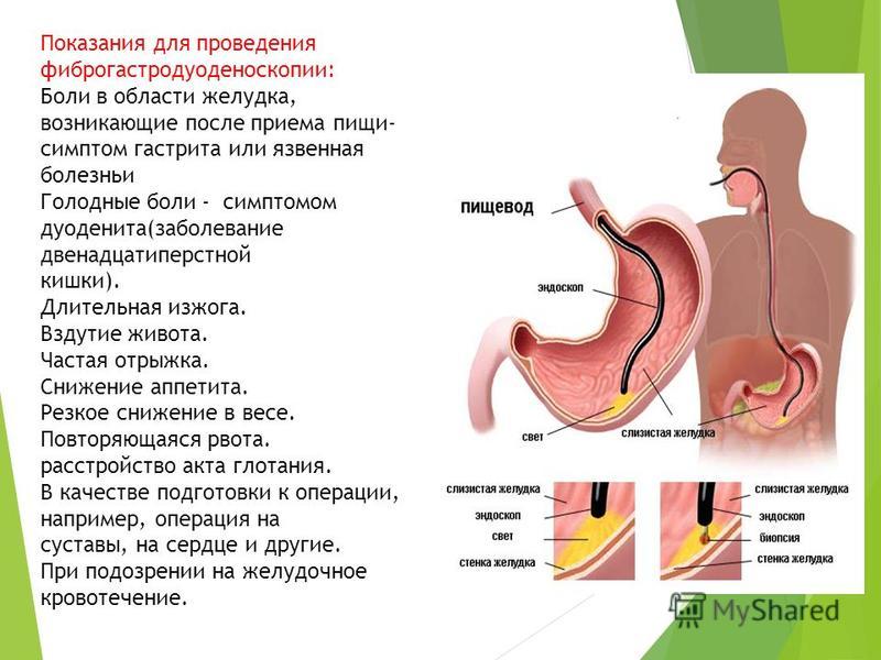 Курсовая работа по теме Эндоскопия пищевода и желудка 