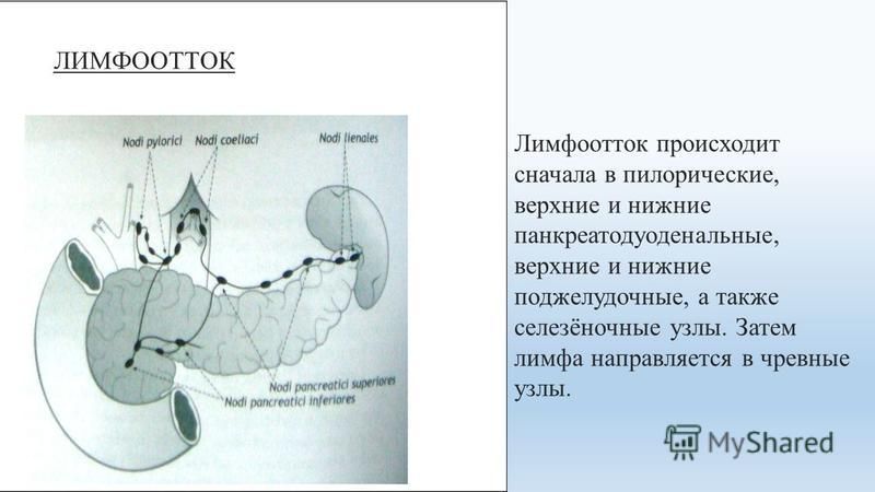ЛИМФООТТОК Лимфоотток происходит сначала в пилорические, верхние и нижние панкреатодуоденальные, верхние и нижние поджелудочные, а также селезёночные узлы. Затем лимфа направляется в чревные узлы.