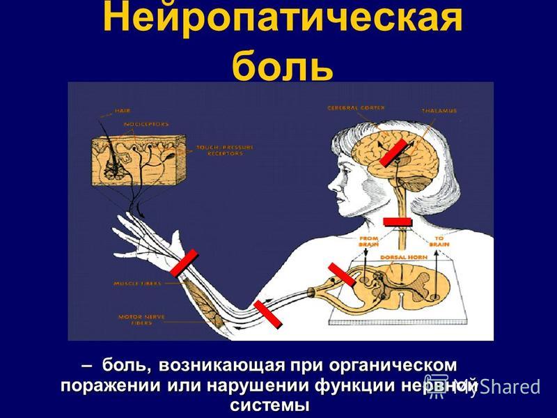 Нейропатическая боль – боль, возникающая при органическом поражении или нарушении функции нервной системы
