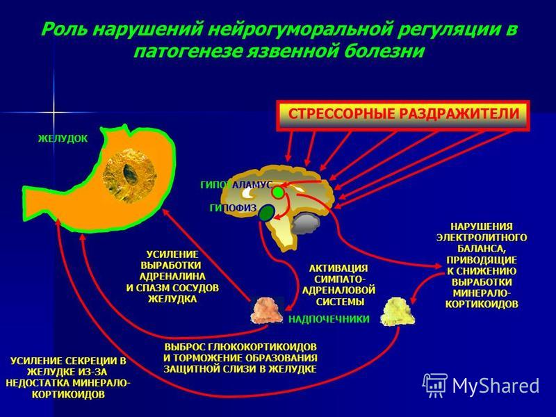 СТРЕССОРНЫЕ РАЗДРАЖИТЕЛИ Роль нарушений нейрогуморальной регуляции в патогенезе язвенной болезни ГИПОТАЛАМУС ГИПОФИЗ АКТИВАЦИЯ СИМПАТО- АДРЕНАЛОВОЙ СИСТЕМЫ НАДПОЧЕЧНИКИ ЖЕЛУДОК УСИЛЕНИЕ ВЫРАБОТКИ АДРЕНАЛИНА И СПАЗМ СОСУДОВ ЖЕЛУДКА ВЫБРОС ГЛЮКОКОРТИКО