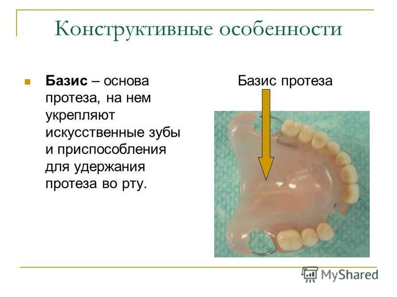 Конструктивные особенности Базис – основа протеза, на нем укрепляют искусственные зубы и приспособления для удержания протеза во рту. Базис протеза