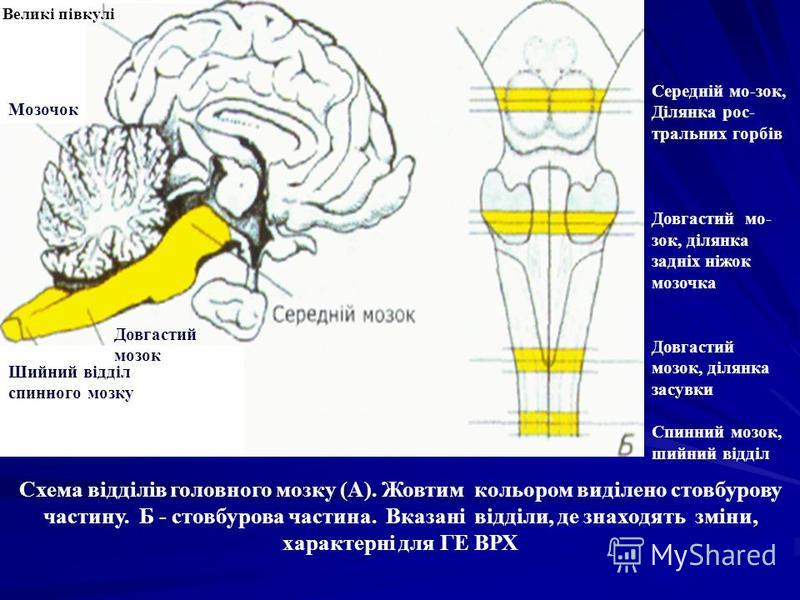 Середній мо-зок, Ділянка рос- тральних горбів Довгастий мо- зок, ділянка задніх ніжок мозочка Довгастий мозок, ділянка засувки Спинний мозок, шийний відділ Схема відділів головного мозку (А). Жовтим кольором виділено стовбурову частину. Б - стовбуров
