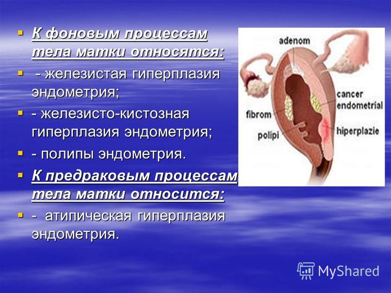 К фоновым процессам тела матки относятся: К фоновым процессам тела матки относятся: - железистая гиперплазия эндометрия; - железистая гиперплазия эндометрия; - железисто-кистозная гиперплазия эндометрия; - железисто-кистозная гиперплазия эндометрия; 