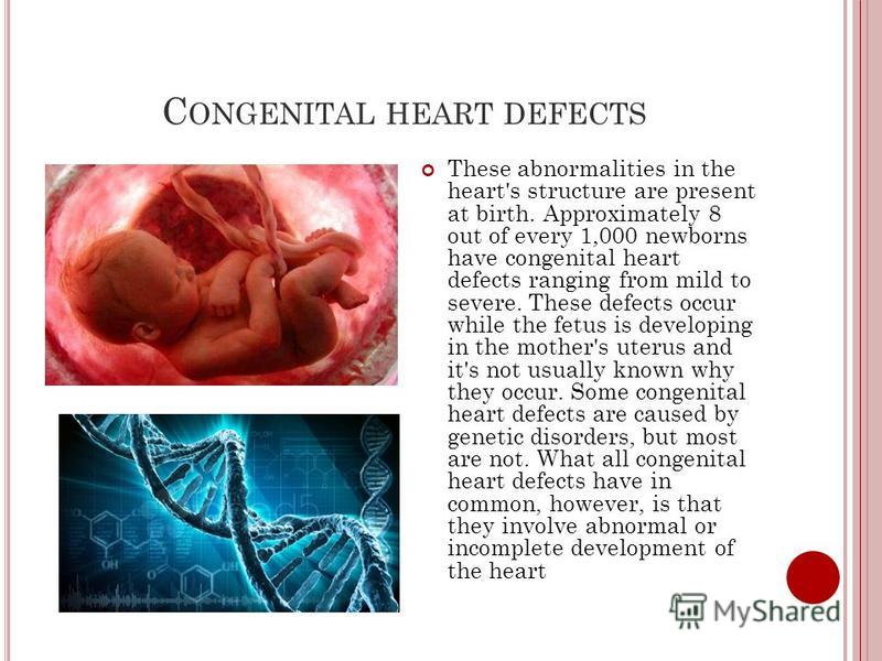 C ONGENITAL HEART DEFECTS These abnormalities in the heart's structure are present at birth. Approximately 8 out of every 1,000 newborns have congenital heart defects ranging from mild to severe. These defects occur while the fetus is developing in t