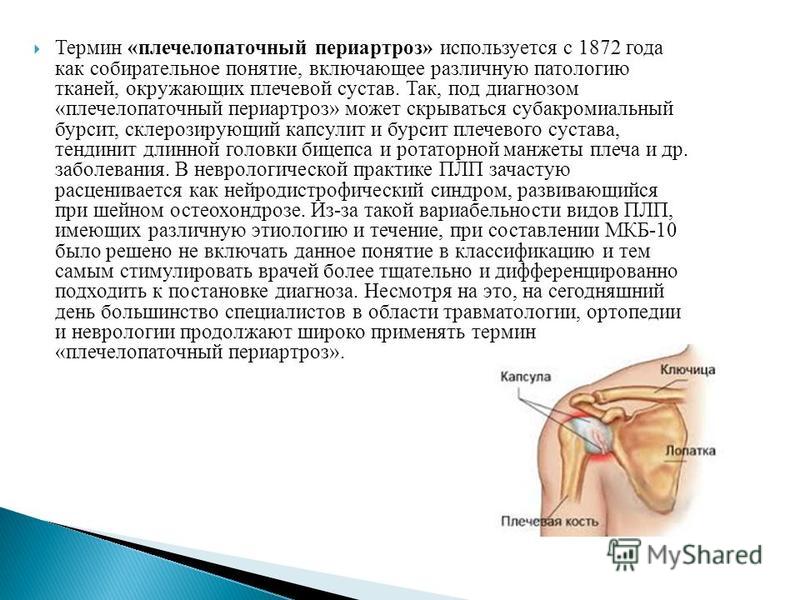 Термин «плече-лопаточный периартроз» используется с 1872 года как собирательное понятие, включающее различную патологию тканей, окружающих плечевой сустав. Так, под диагнозом «плече-лопаточный периартроз» может скрываться субакромиальный бурсит, скле