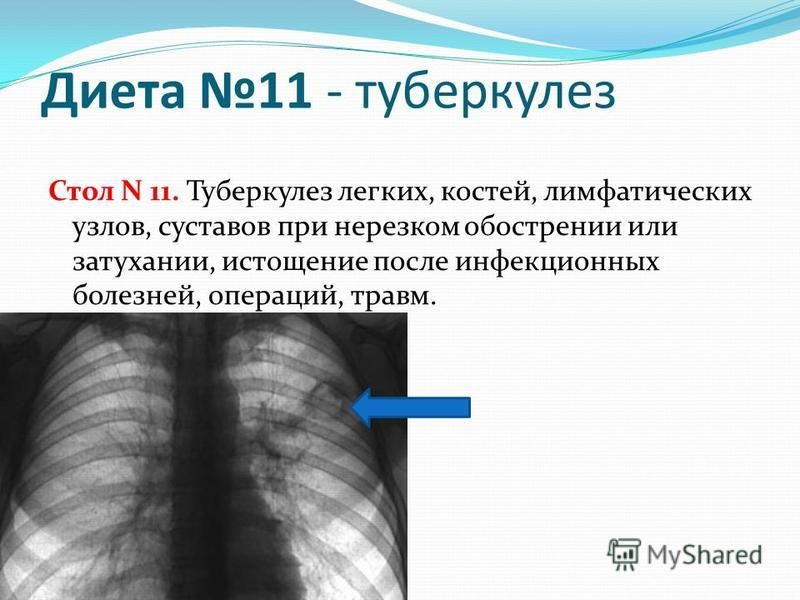 Стол 11 Диета При Туберкулезе