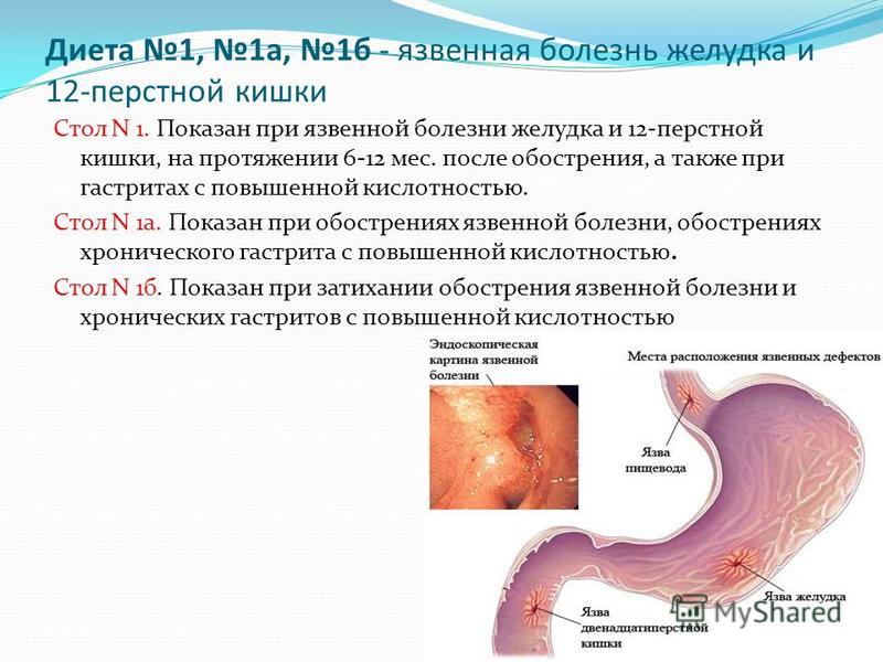 Диета 1, 1 а, 1 б - язвенная болезнь желудка и 12-перстной кишки Стол N 1. Показан при язвенной болезни желудка и 12-перстной кишки, на протяжении 6-12 мес. после обострения, а также при гастритах с повышенной кислотностью. Стол N 1 а. Показан при об