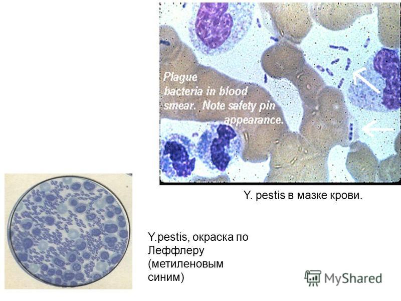 Y.pestis, окраска по Леффлеру (метиленовым синим) Y. рestis в мазке крови.