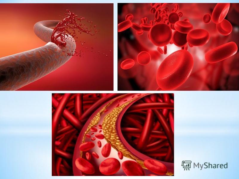 Что такое гемофилия? * Гемофилия, шире коагулопатия - заболевание крови, характеризующееся повышенной кровоточивостью, причиной которой является нарушение свертываемости крови. * Нормальная свертываемость крови предотвращает и останавливает кровоизли