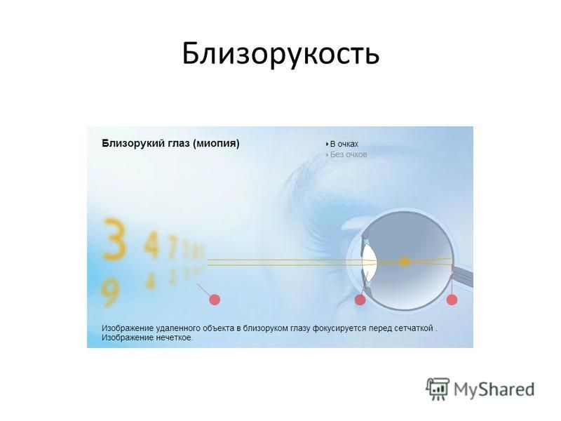 Реферат: Глаз как оптическая система