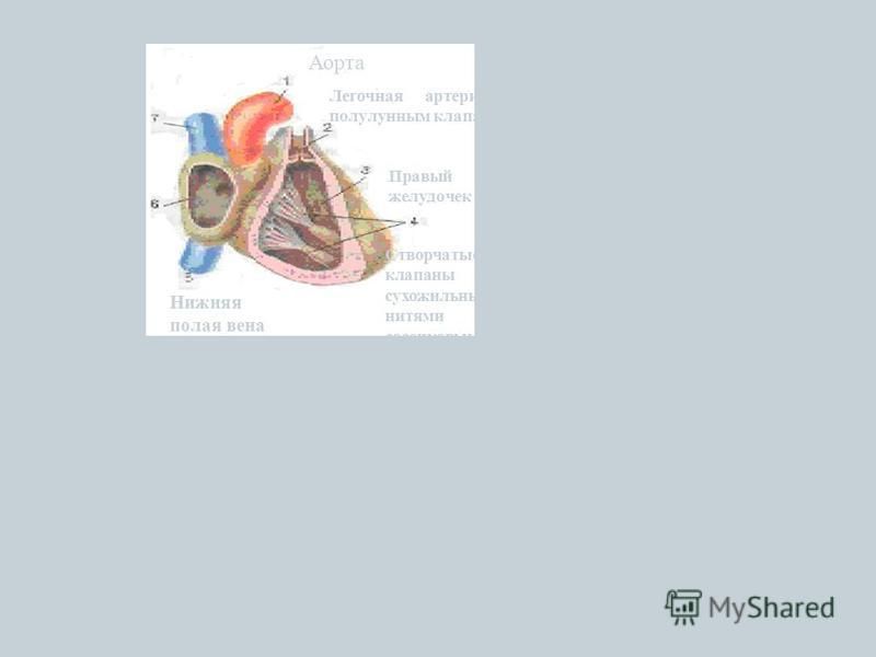 Из левого желудочка кровь поступает в аорту (самая крупная артерия), из правого желудочка – в легочную артерию. Аорта Легочная артерия с полулунным клапаном Правый желудочек Створчатые клапаны с сухожильными нитями и сосочковыми мышцами Нижняя полая 