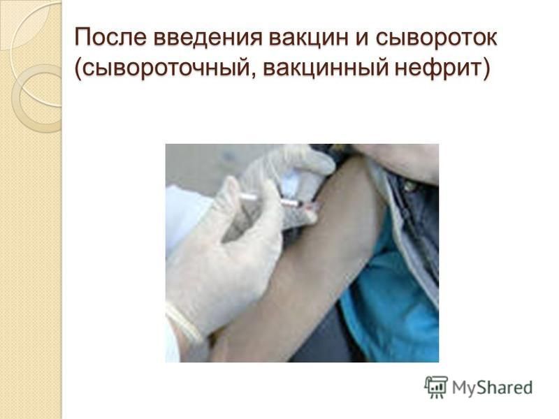 После введения вакцин и сывороток (сывороточный, вакцинный нефрит)