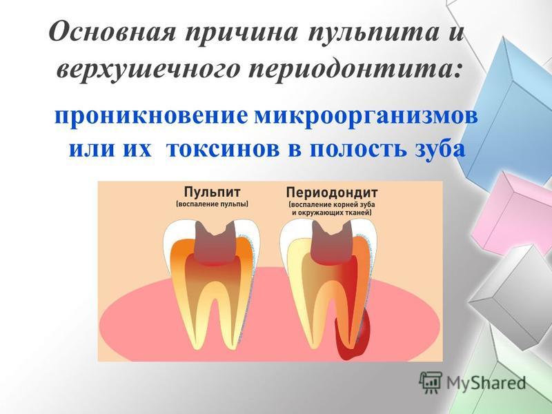 Основная причина пульпита и верхушечного периодонтита: проникновение микроорганизмов или их токсинов в полость зуба