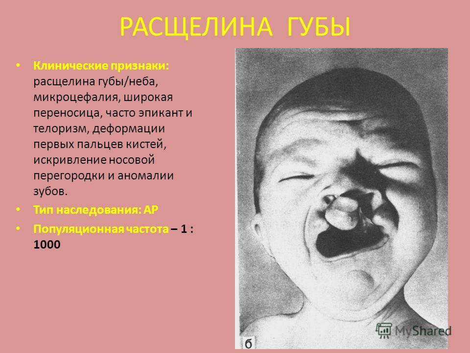 Болезнь вокруг губы и губы Болезнь вокруг губы и губы