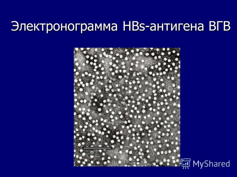 Электронограмма HBs-антигена ВГВ