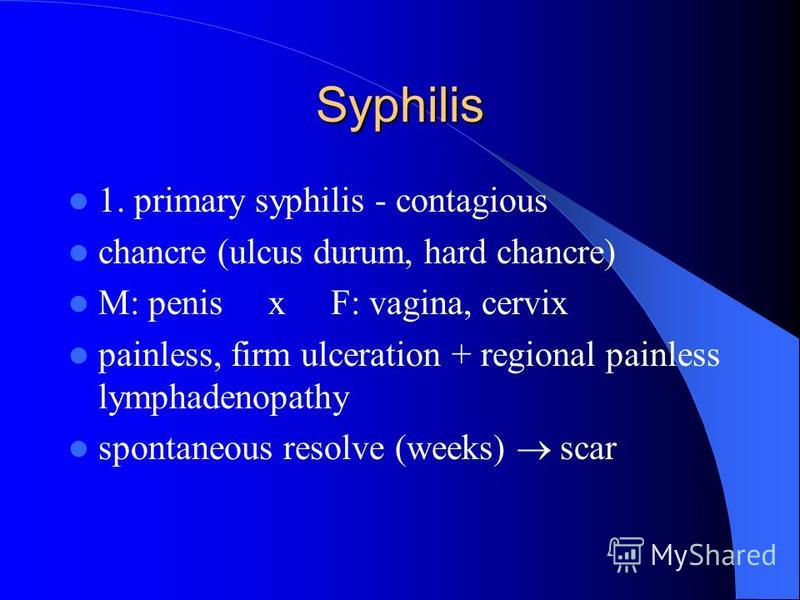 Syphilis 1. primary syphilis - contagious chancre (ulcus durum, hard chancre) M: penis x F: vagina, cervix painless, firm ulceration + regional painless lymphadenopathy spontaneous resolve (weeks) scar