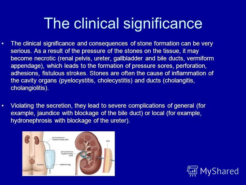The clinical significance The clinical significance and consequences of stone formation can be very serious. As a result of the pressure of the stones on the tissue, it may become necrotic (renal pelvis, ureter, gallbladder and bile ducts, vermiform 